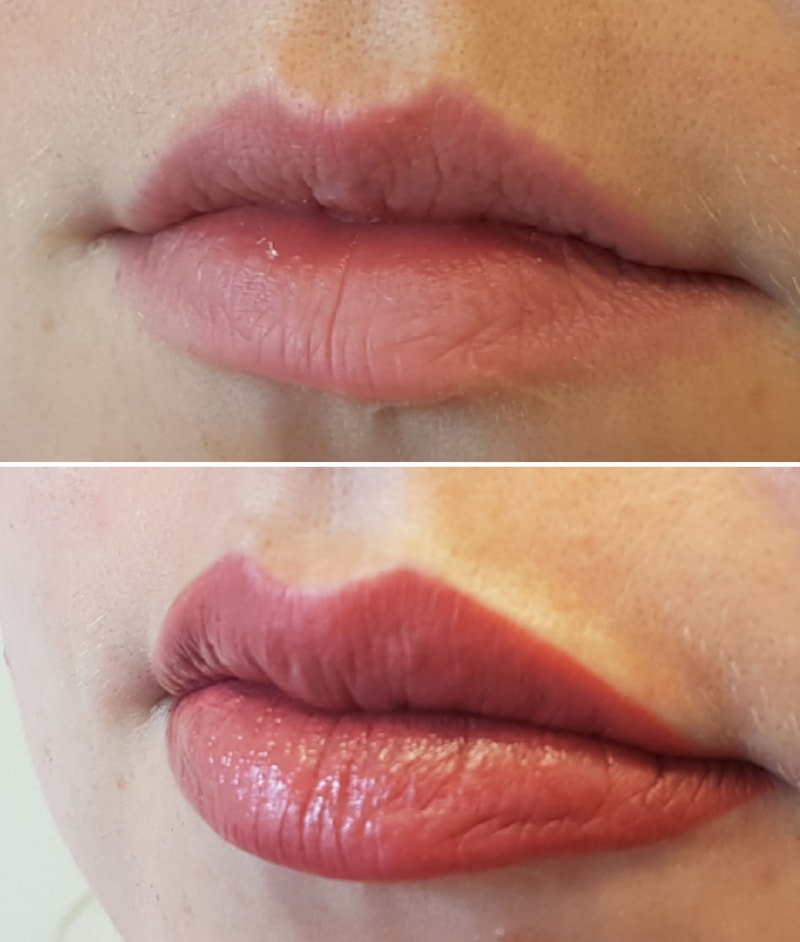 Resultaat permanente make up lippen 3